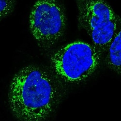 HSDL2 Antibody, Novus Biologicals:Antibodies:Primary Antibodies